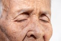 The old woman`s felling lonely.dementia and AlzheimerÃÂ¢Ã¢âÂ¬Ã¢âÂ¢s disease